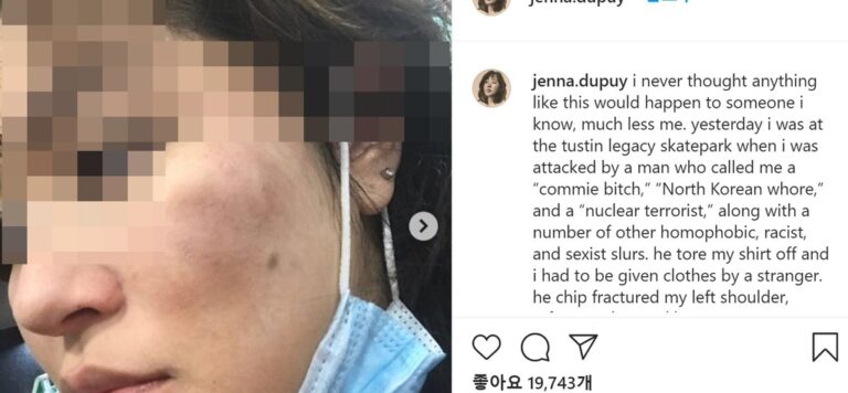 ‘핵 테러리스트’ 욕하며 폭행, 한국계 여성에 또 증오범죄