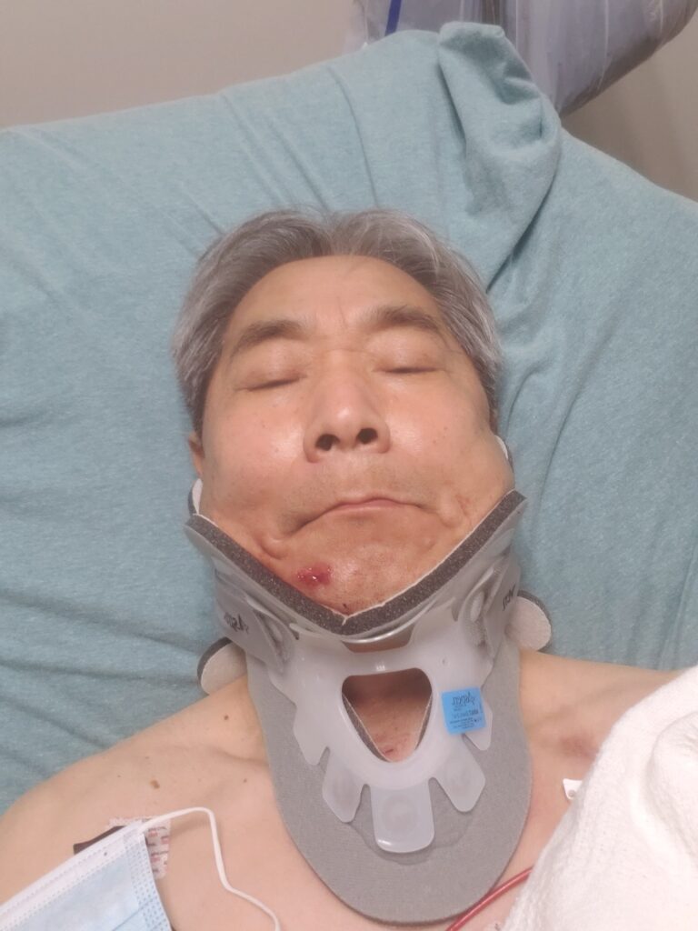 배기성 전 한인회장, 교통사고로 중상